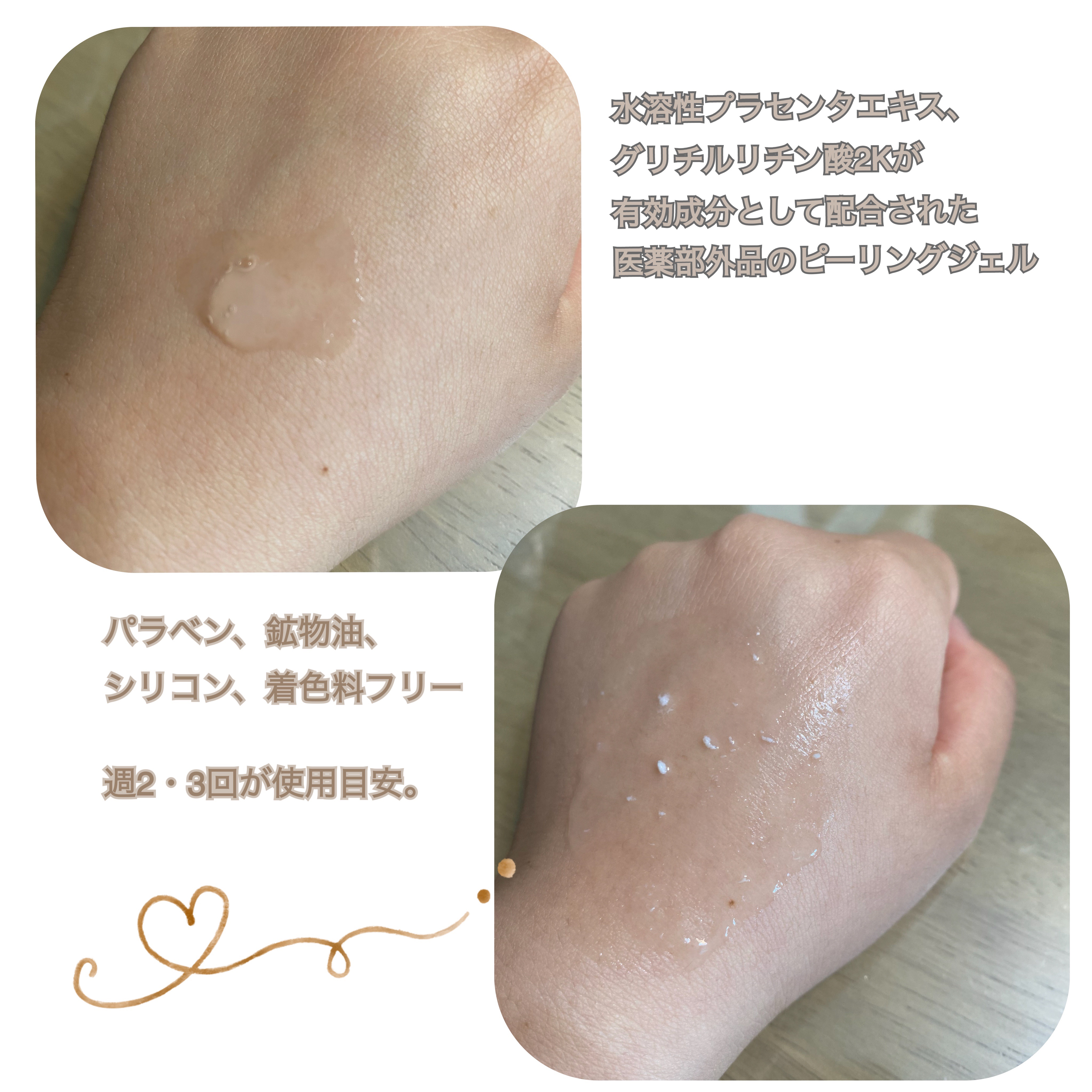 美白乃美人ピーリングジェル/ブレーンコスモス/ピーリングを使ったクチコミ（2枚目）