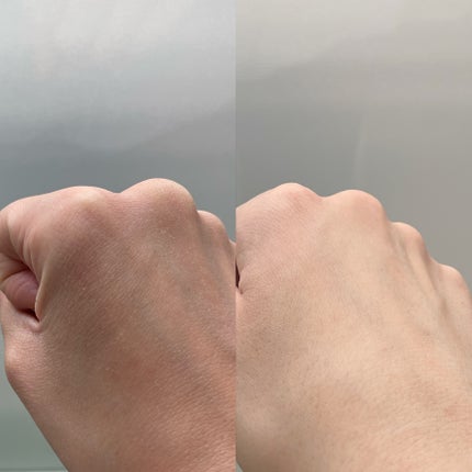 復活草ビフィダセラムファーミングドロップ/Abib /美容液を使ったクチコミ(2枚目)