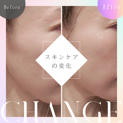 エイシカ365マイクロセラム/AESTURA/美容液を使ったクチコミ(4枚目)