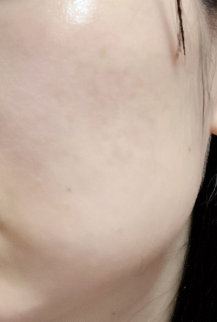 ブライトニングケア ローション M(医薬部外品)/アクアレーベル/化粧水を使ったクチコミ(1枚目)