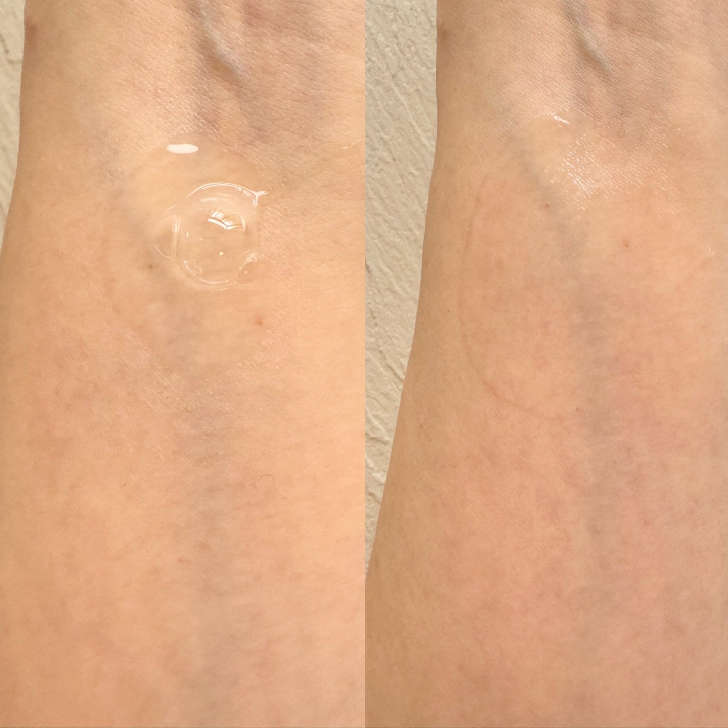 リマージ糸リフティングアンプル/REVENIP/美容液を使ったクチコミ(5枚目)