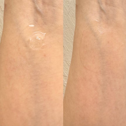 リマージ糸リフティングアンプル/REVENIP/美容液を使ったクチコミ(5枚目)