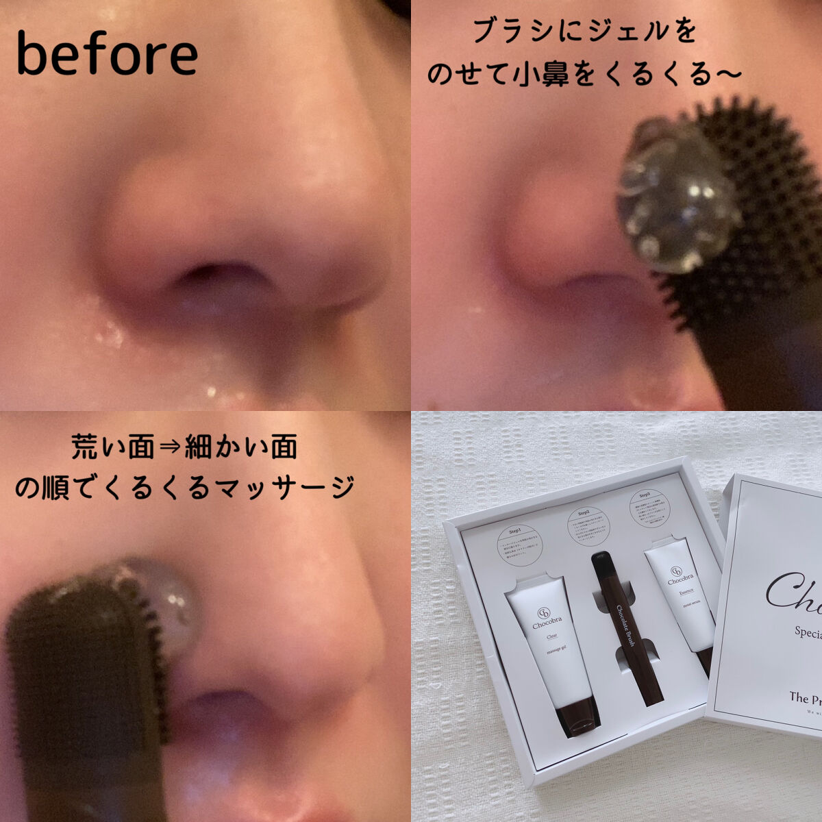 チョコブラ スペシャル毛穴ケアセット/Chocobra/スキンケアキットを使ったクチコミ（3枚目）