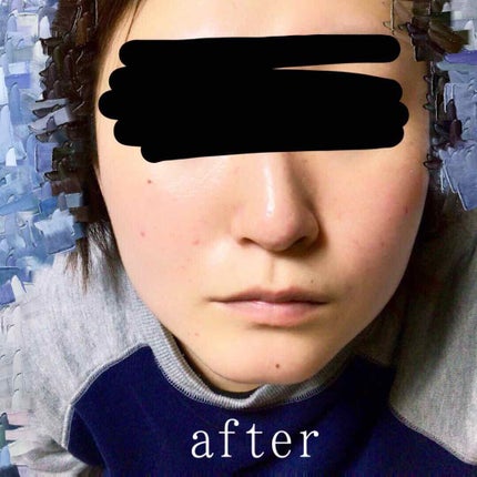 クレイローション/b.glen/化粧水を使ったクチコミ(3枚目)