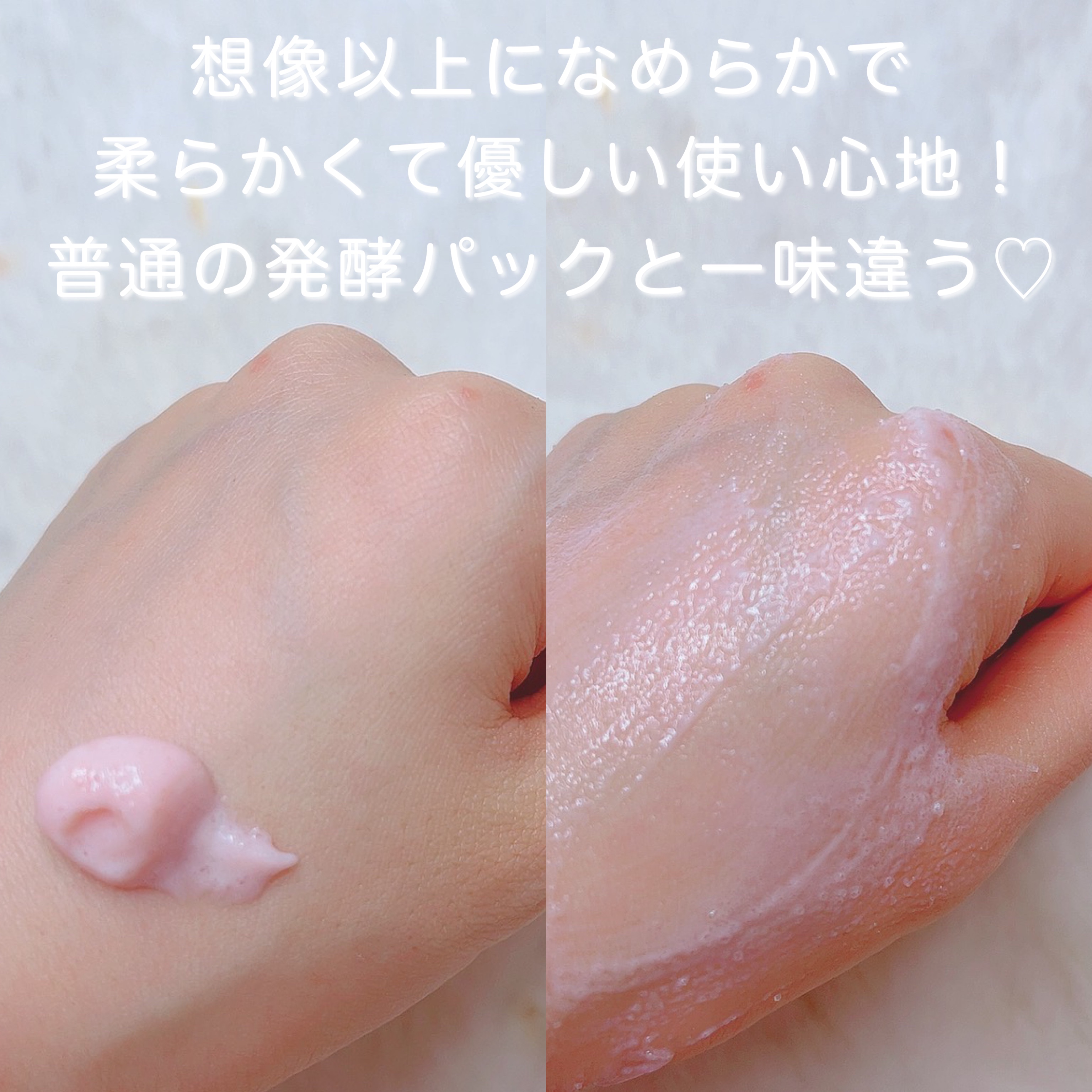 ピンクティーツリーライスシカウォッシュオフパック/APLIN/洗い流すパック・マスクを使ったクチコミ（2枚目）