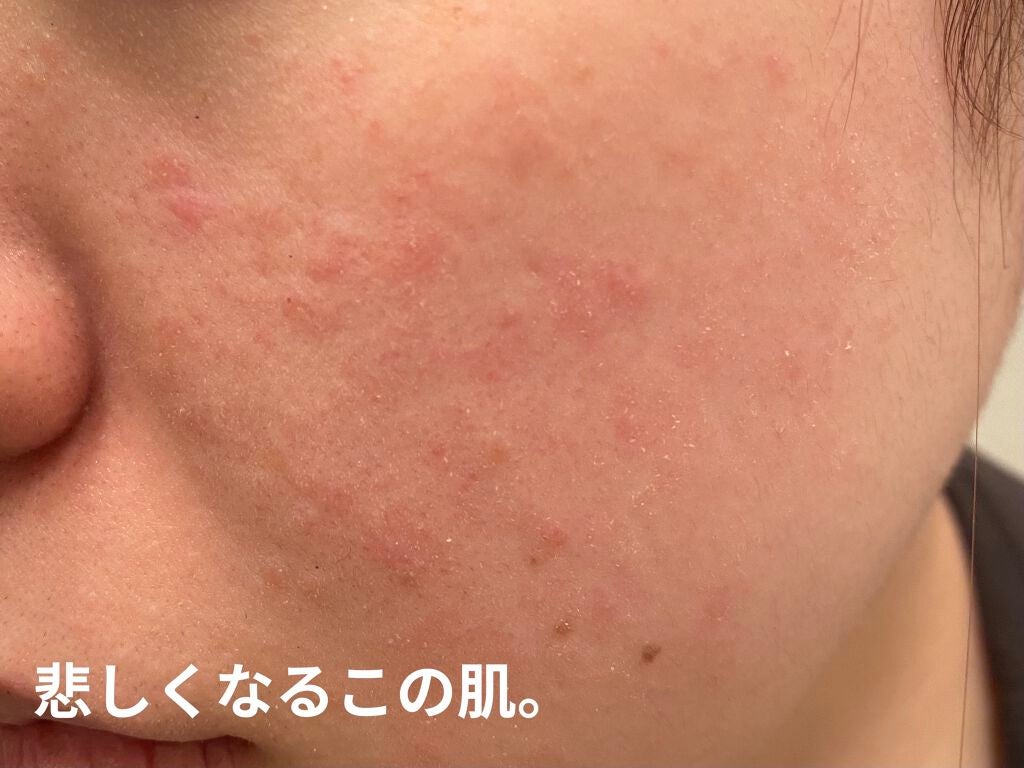 クレンジングバーム モイスト/CLAYGE/クレンジングバームを使ったクチコミ(6枚目)