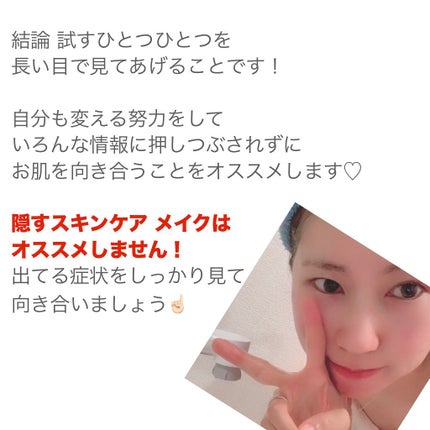 みん on LIPS 「みなさんこんにちは!今回はニキビに悩んでいた私が治った理由につ..」(7枚目)