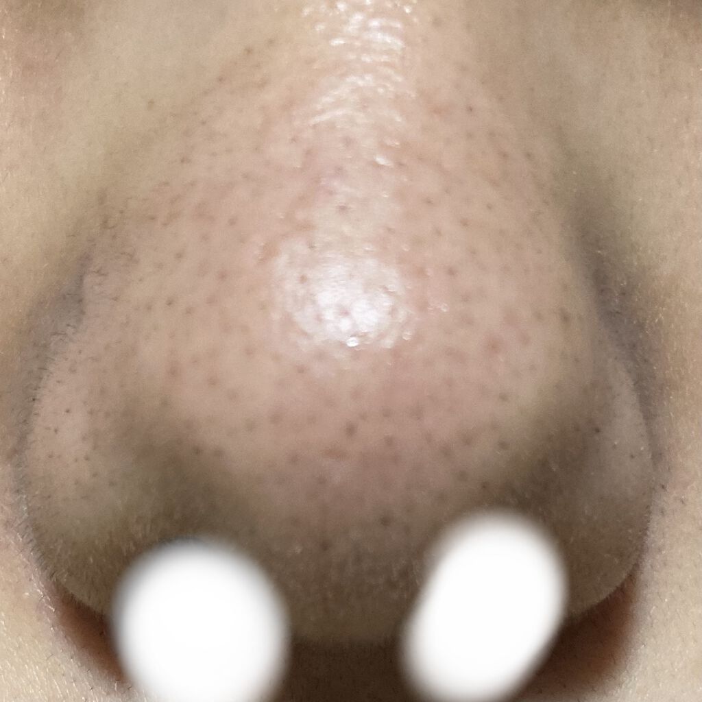 デュオ ザ クレンジングバーム ブラック/DUO/クレンジングバームを使ったクチコミ（3枚目）