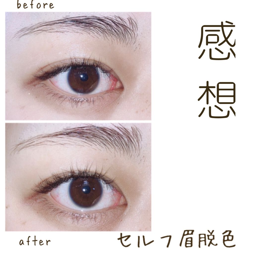 脱色クリーム 敏感肌用/エピラット/ムダ毛ケアを使ったクチコミ(1枚目)