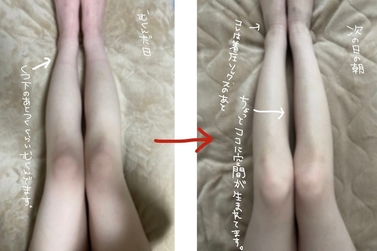 寝ながらメディキュット スパッツ 骨盤テーピング/メディキュット/着圧ソックス・レギンスを使ったクチコミ(4枚目)