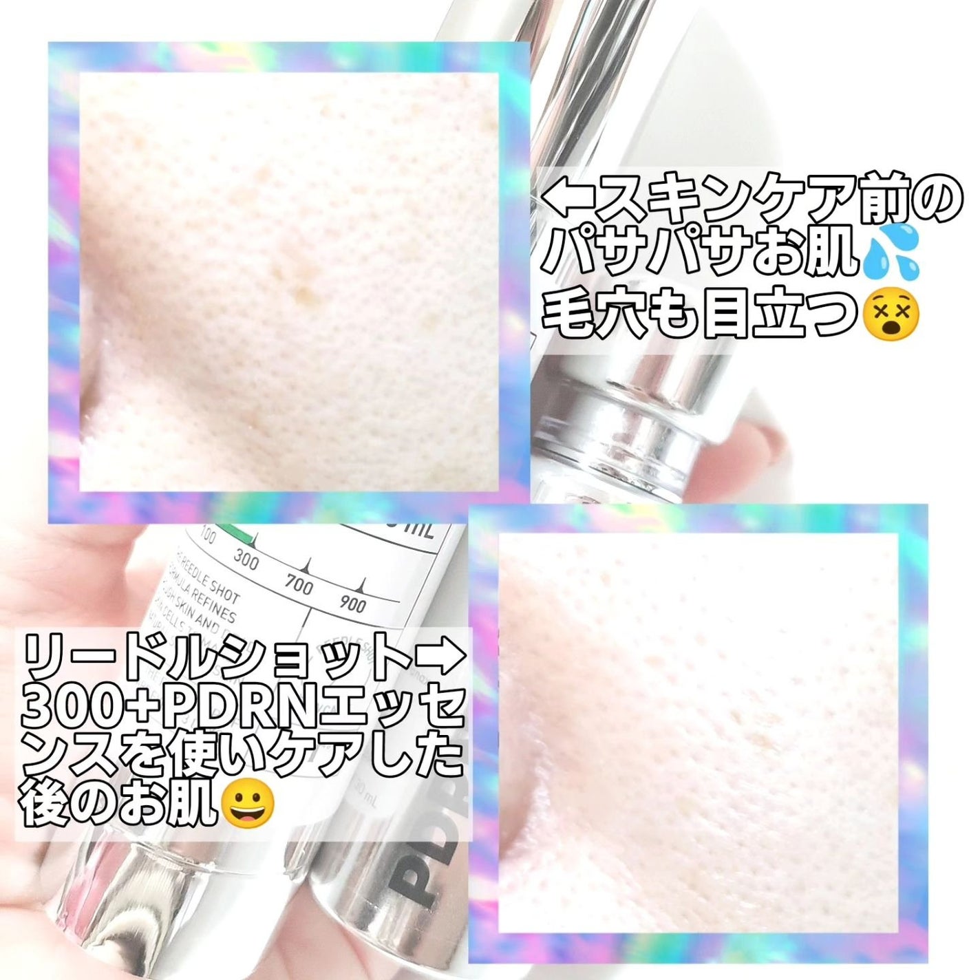 リードルショット300/VT/美容液を使ったクチコミ(7枚目)