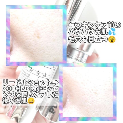 リードルショット300/VT/美容液を使ったクチコミ(7枚目)