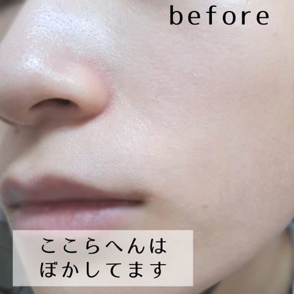 ダーマセプトRX AZAセラム/ダーマセプトRX/美容液を使ったクチコミ(3枚目)