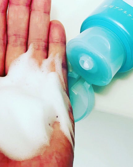 パーフェクトホイップ アクネケア/SENKA(専科)/洗顔フォームを使ったクチコミ(2枚目)