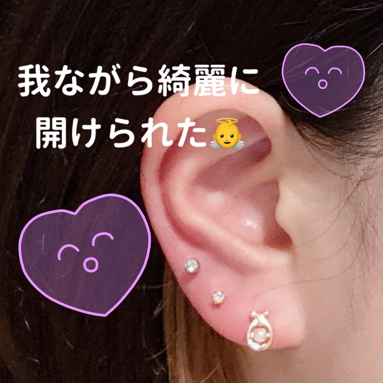 瞬間ピアッサー Q66/ヒーロー /その他を使ったクチコミ（2枚目）