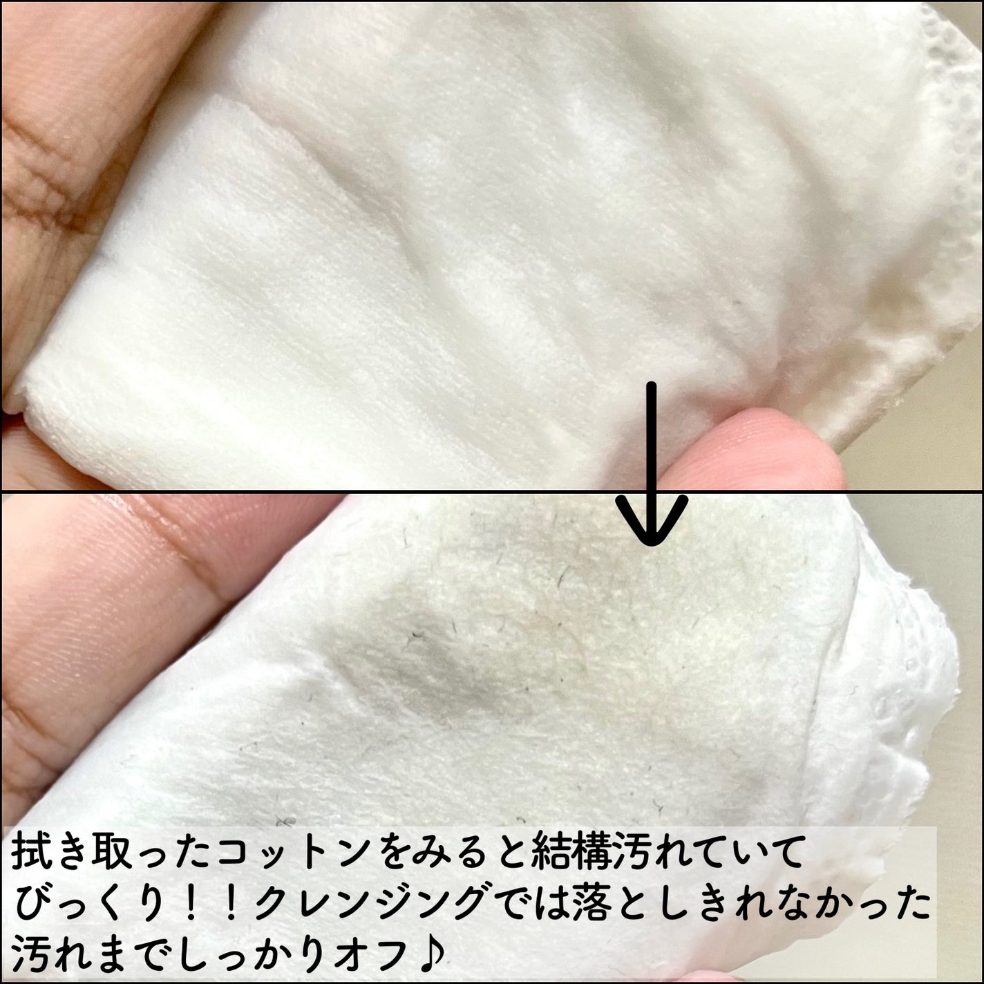 AHA·BHA·PHA 30デイズミラクルトナー/SOME BY MI/化粧水を使ったクチコミ(3枚目)