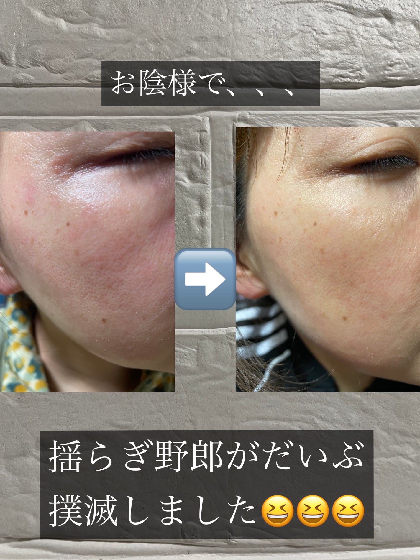 金木犀プレミアムフェイシャルマスク/Infinity/シートマスク・パックを使ったクチコミ(3枚目)