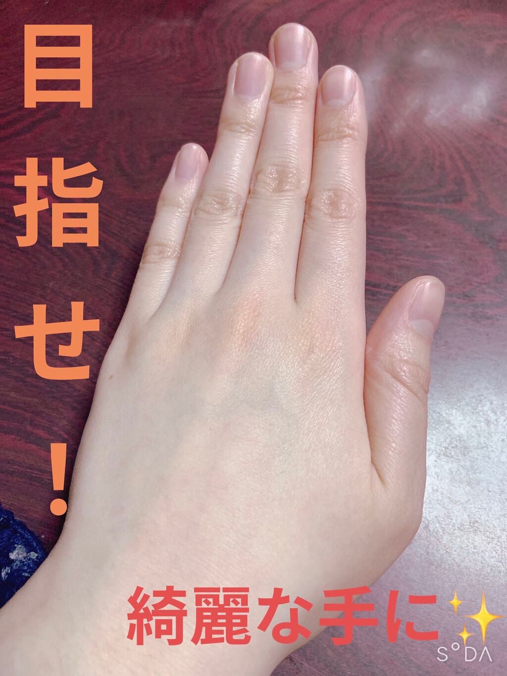 メディカルクリームG(薬用クリームG)/メンターム/ハンドクリームを使ったクチコミ(3枚目)