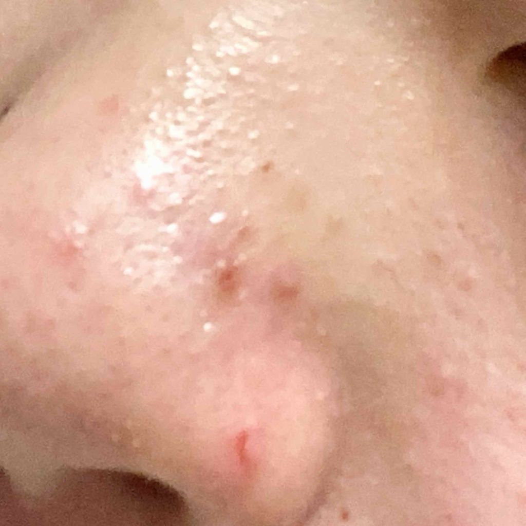 ハトムギ化粧水(ナチュリエ スキンコンディショナー R )/ナチュリエ/化粧水を使ったクチコミ(3枚目)