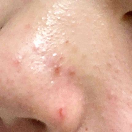 ハトムギ化粧水(ナチュリエ スキンコンディショナー R )/ナチュリエ/化粧水を使ったクチコミ(3枚目)