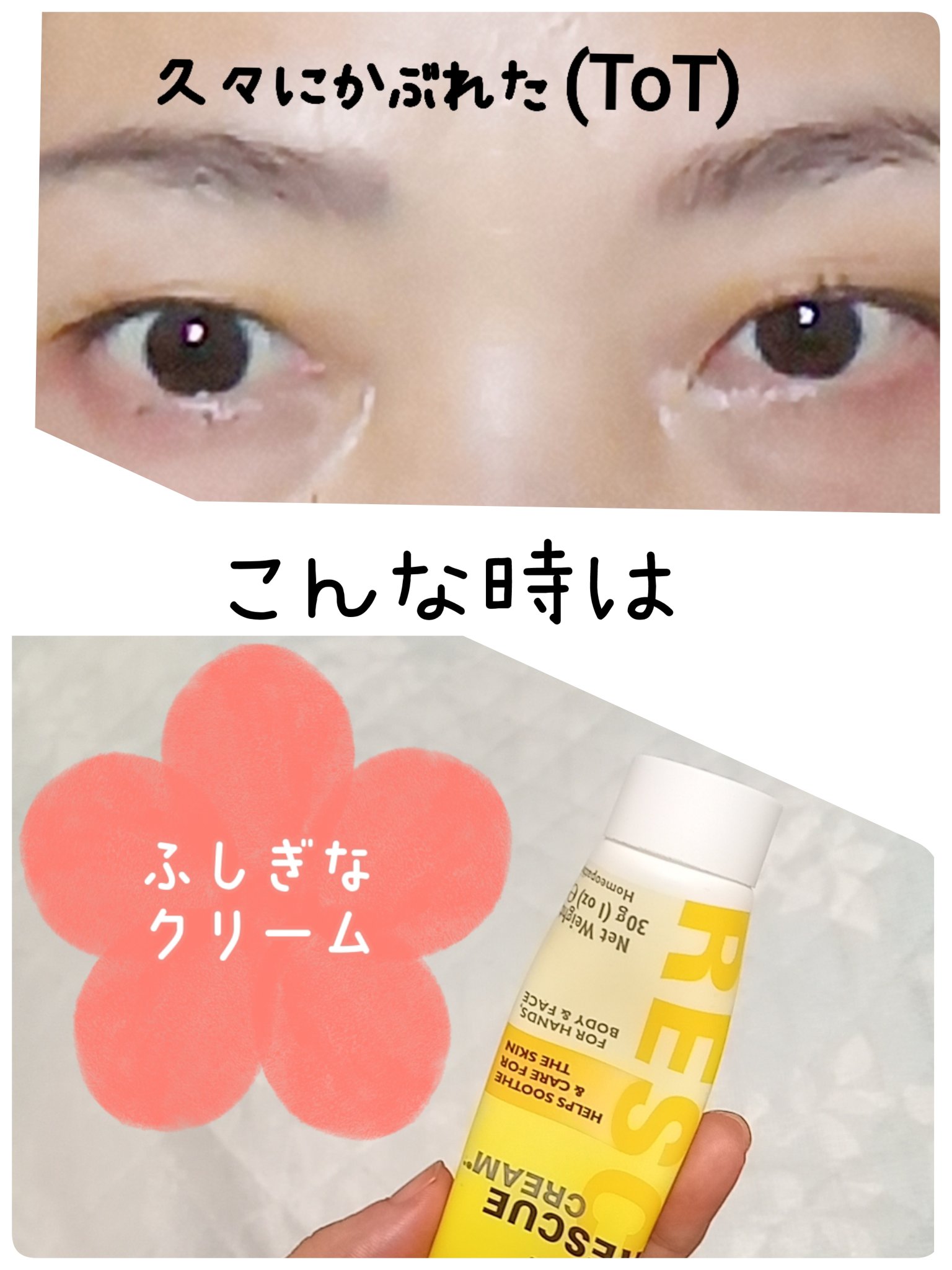 レスキュークリーム/バッチフラワーレメディ/フェイスクリームを使ったクチコミ（1枚目）