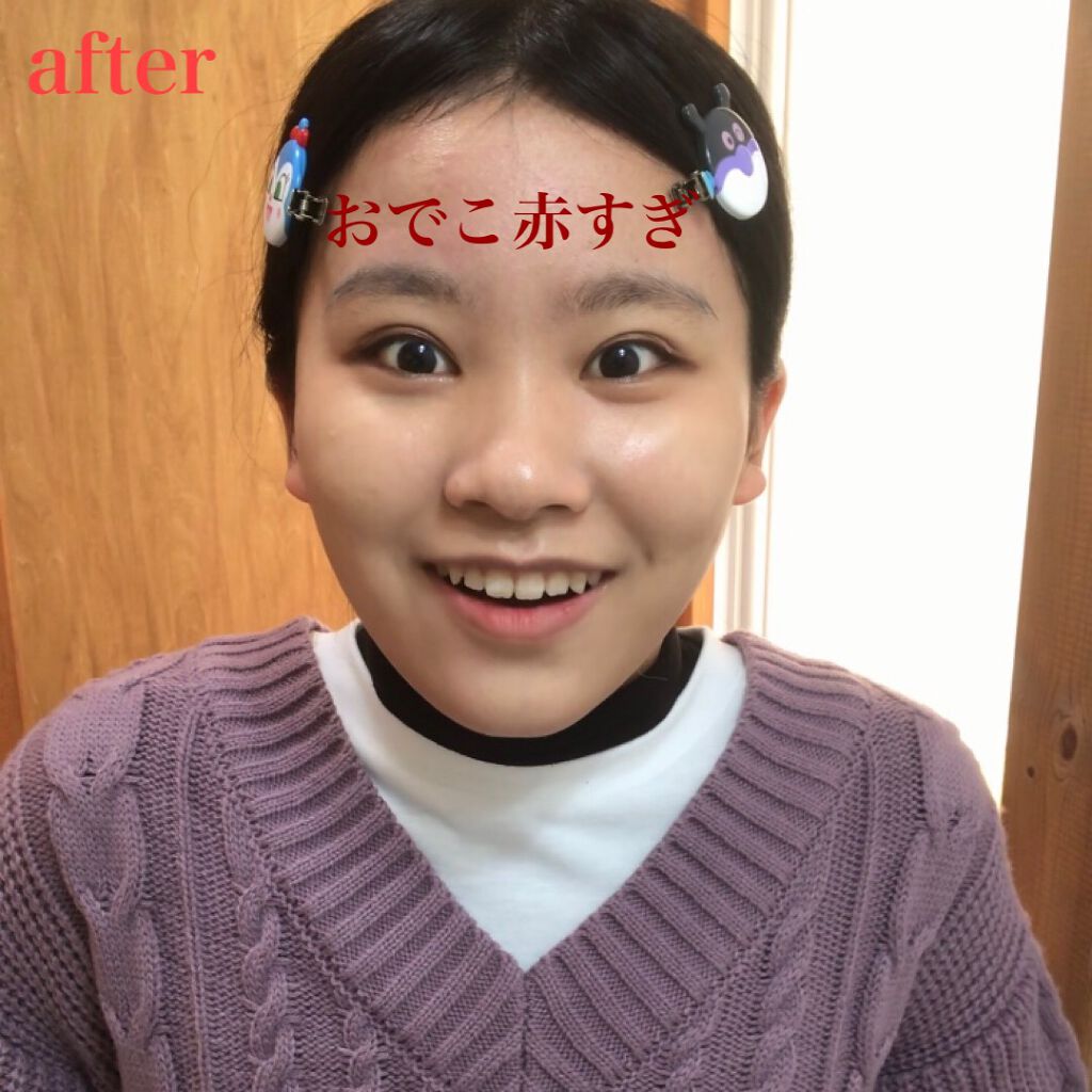 ウジイエ有紀 on LIPS 「ビフォーアフター見たくて動画撮ってたんだけど普通に顔がウケる。..」(4枚目)