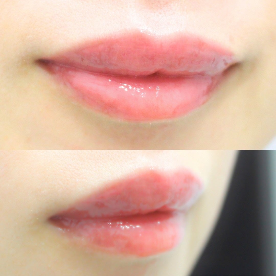 フィー 3Dボリューミンググロス/fwee/リップグロスを使ったクチコミ(3枚目)