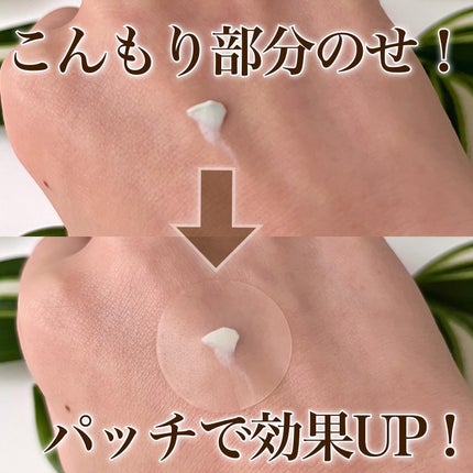 アクネスラボ 相澤メソッド 薬用ミドリクリーム/HIN アクネスラボ/フェイスクリームを使ったクチコミ(3枚目)