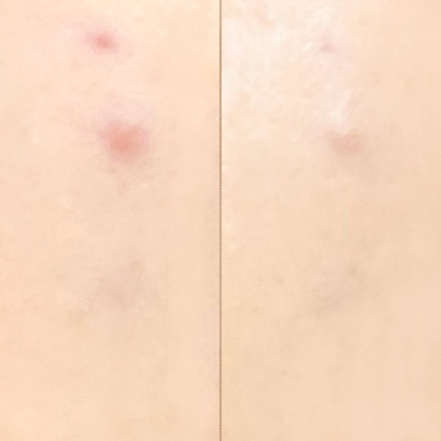 è¬çš ãªã³ã¯ã«ãã¯ã€ã ã¯ãã·ã§ã³BB/ONLY MINERALS/ã¯ãã·ã§ã³ãã¡ã³ããŒã·ã§ã³ã䜿ã£ãã¯ãã³ãïŒ6æç®ïŒ