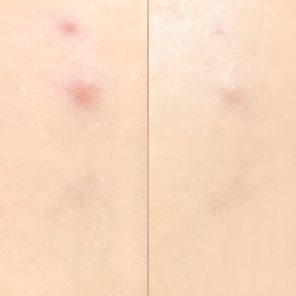 è¬çš ãªã³ã¯ã«ãã¯ã€ã ã¯ãã·ã§ã³BB/ONLY MINERALS/ã¯ãã·ã§ã³ãã¡ã³ããŒã·ã§ã³ã䜿ã£ãã¯ãã³ãïŒ6æç®ïŒ