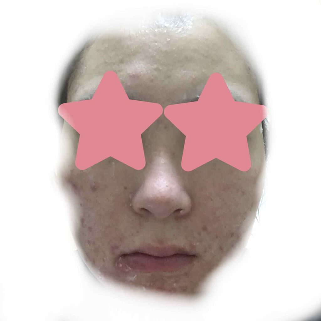 フェイスクレイウォッシュ/クレイビューティ/洗顔フォームを使ったクチコミ(2枚目)