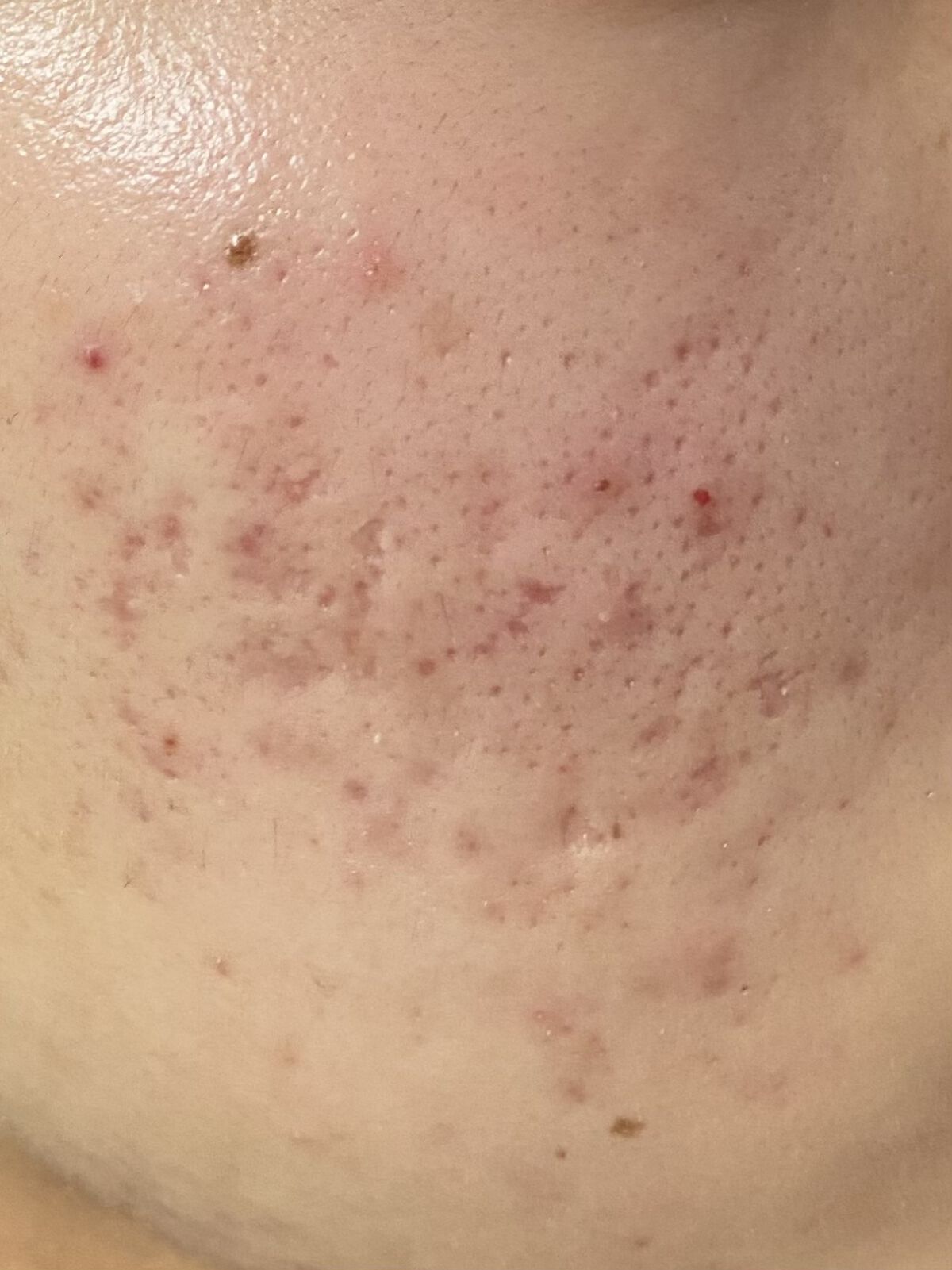 ウオーター/アベンヌ/ミスト状化粧水を使ったクチコミ（1枚目）