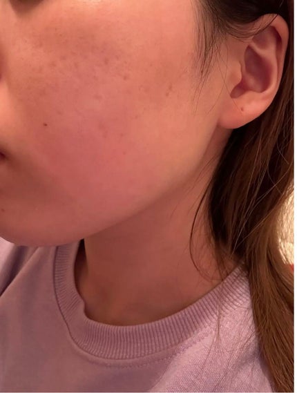 エッセンス ミルキークリーム (しっとり)/アルージェ/フェイスクリームを使ったクチコミ(3枚目)