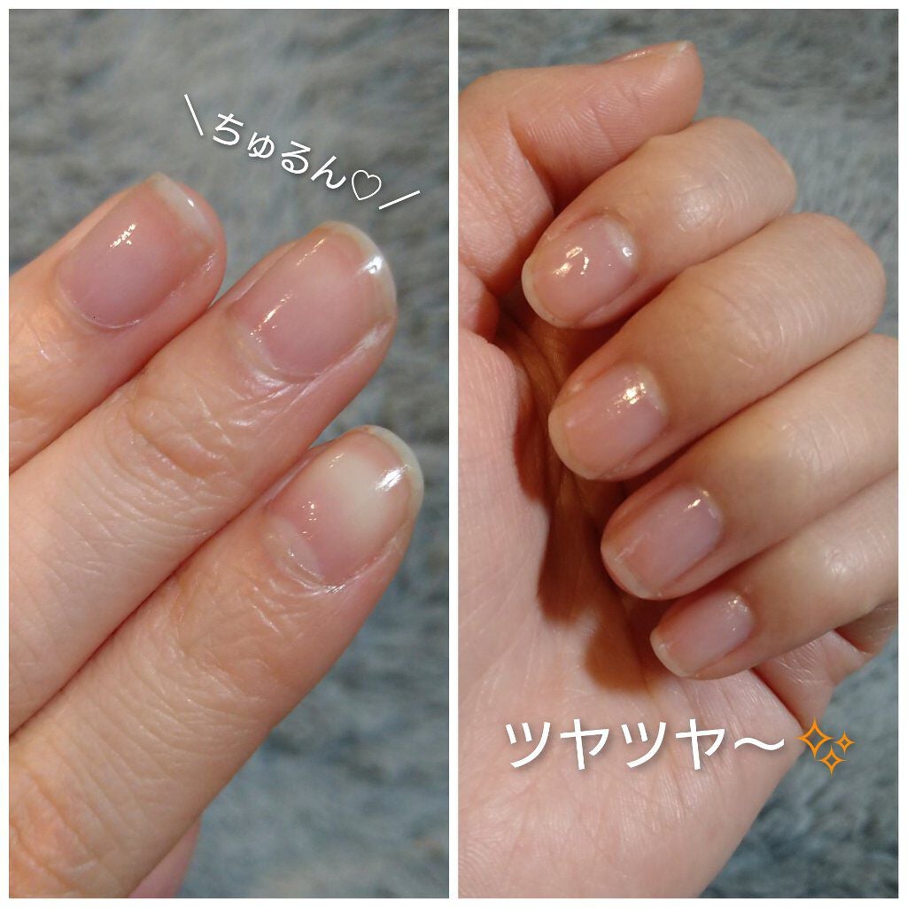 エテュセ クイックケアコート/ettusais/ネイルオイル・トリートメントを使ったクチコミ(6枚目)