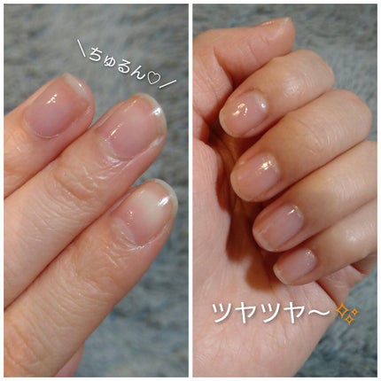 エテュセ クイックケアコート/ettusais/ネイルオイル・トリートメントを使ったクチコミ(6枚目)