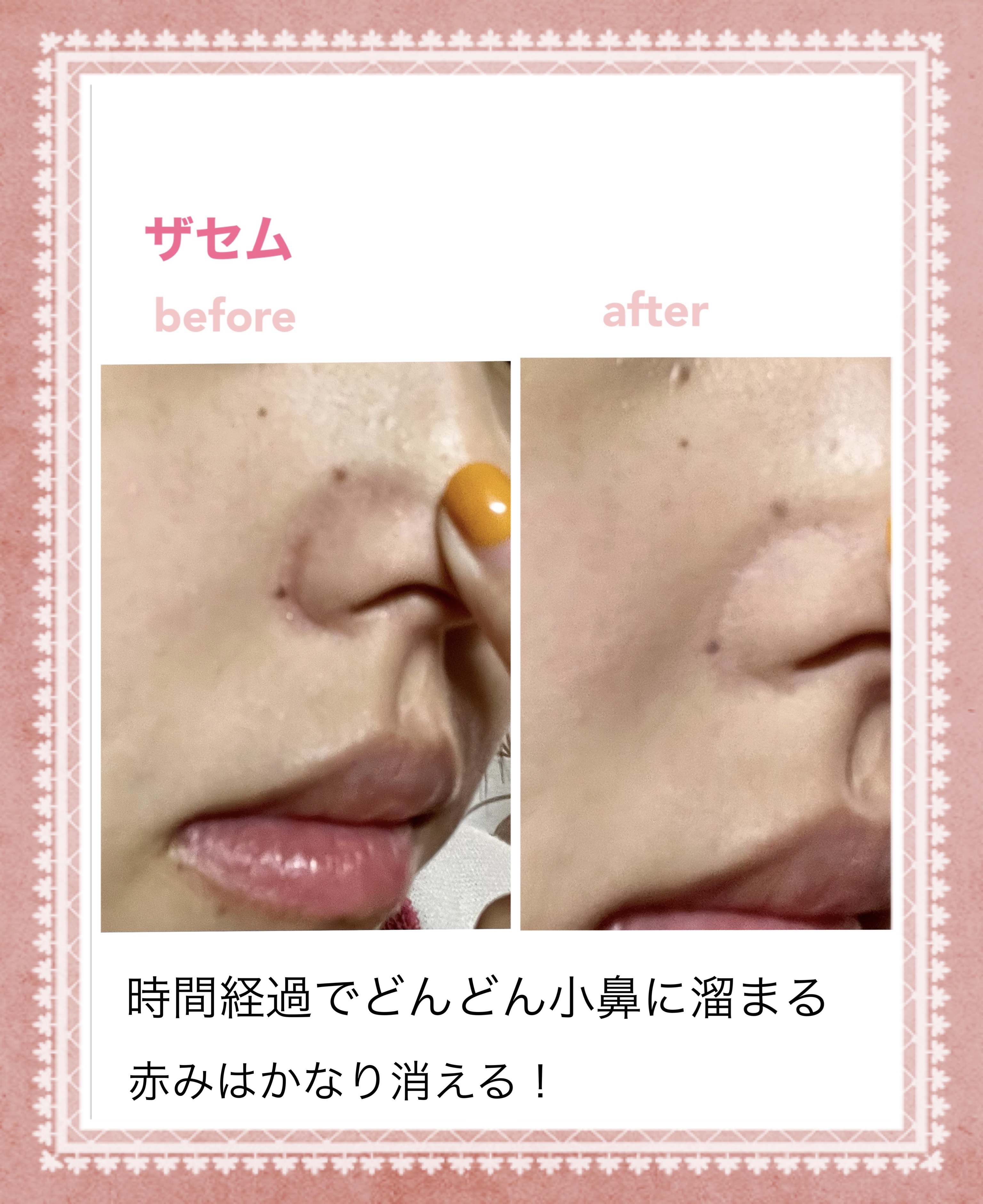 アイシャドウブラシセット/ロージーローザ/メイクブラシを使ったクチコミ（2枚目）