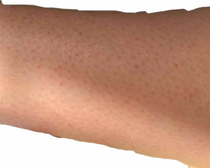 を使ったクチコミ(3枚目)