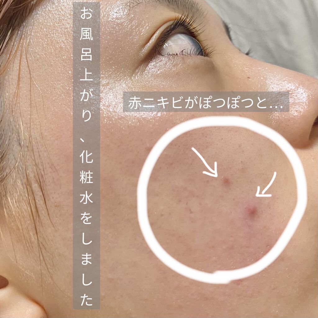 フレッシュリージュースドビタミンドロップ(35ml)/Klairs/美容液を使ったクチコミ（2枚目）