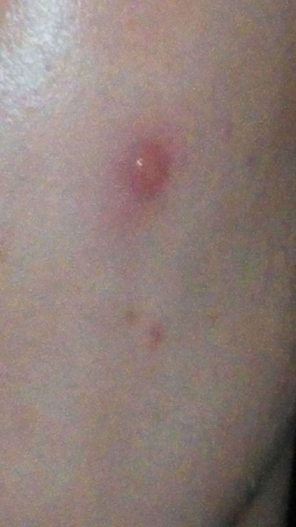 VCスターターセット/VCシリーズ/スキンケアキットを使ったクチコミ(3枚目)