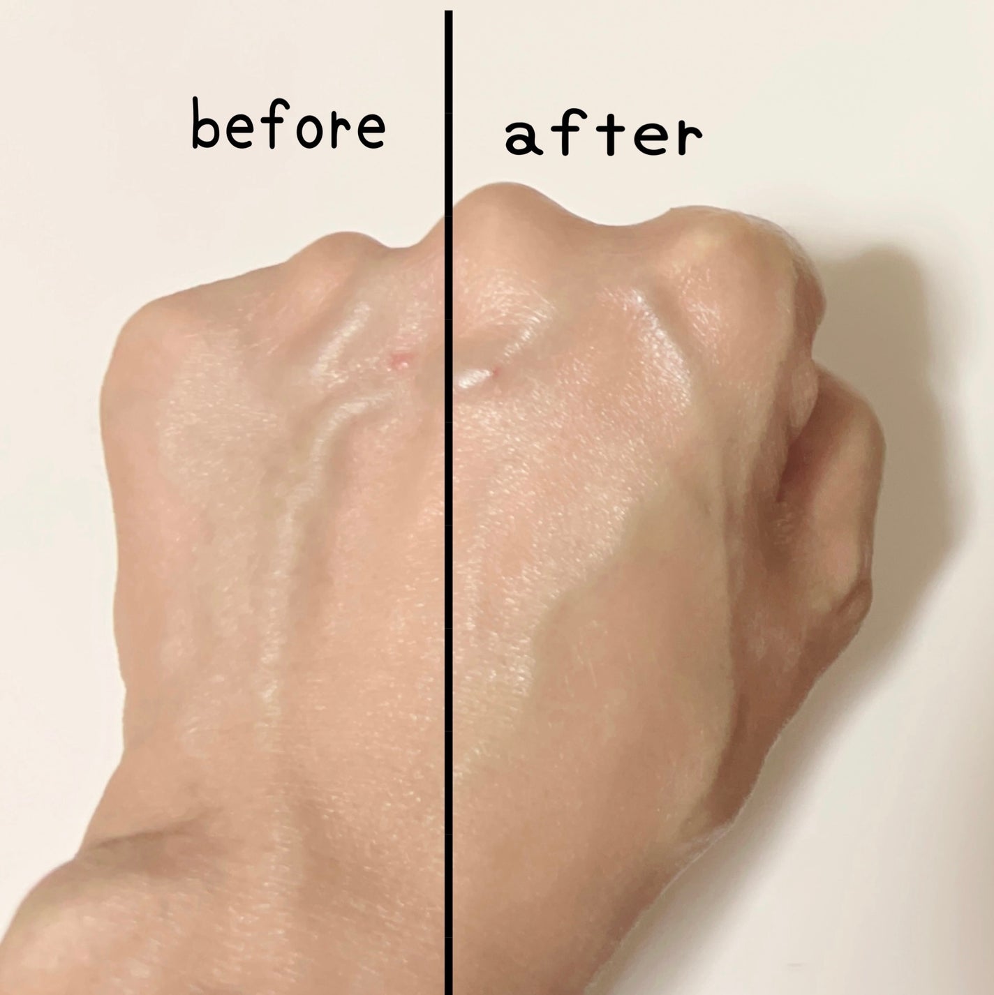 ディメラナイザートーニングアンプル/PHYSIOGEL/美容液を使ったクチコミ(5枚目)