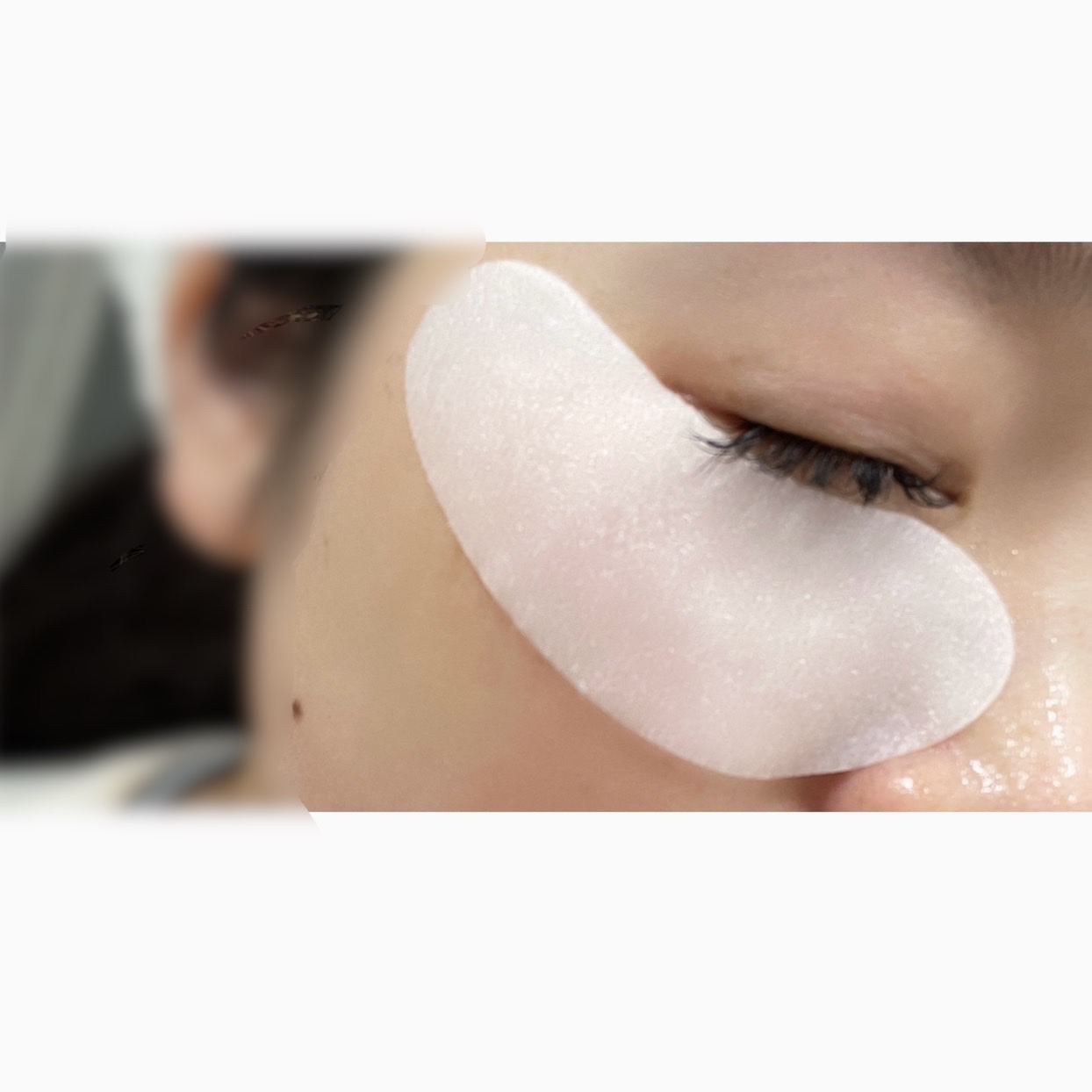 ダーマレーザー アイシート スーパーVCR/クオリティファースト/アイケア・アイクリームを使ったクチコミ（3枚目）