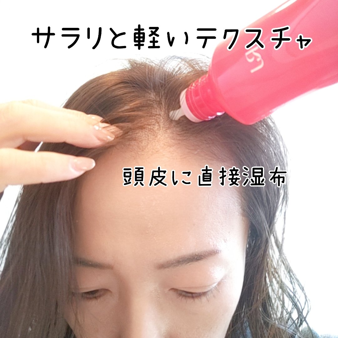 薬用 RJ地肌ケア エッセンス /アピセラピーコスメティクス/頭皮ローションを使ったクチコミ（2枚目）