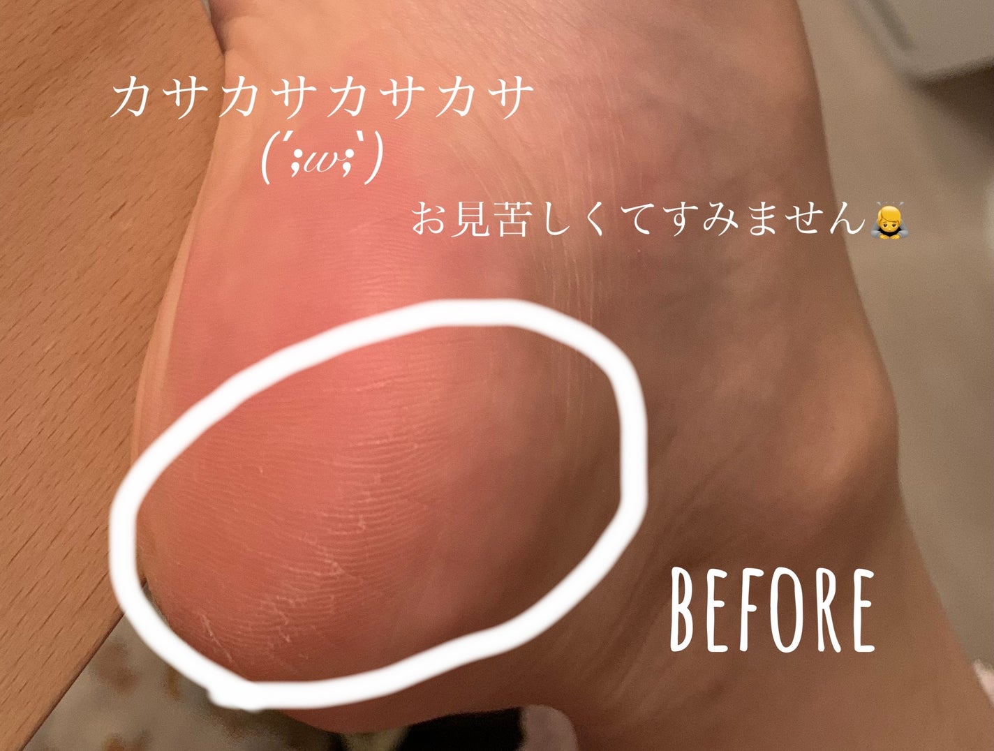 ゴウンバル クリーム/3WB/レッグ・フットケアを使ったクチコミ(2枚目)