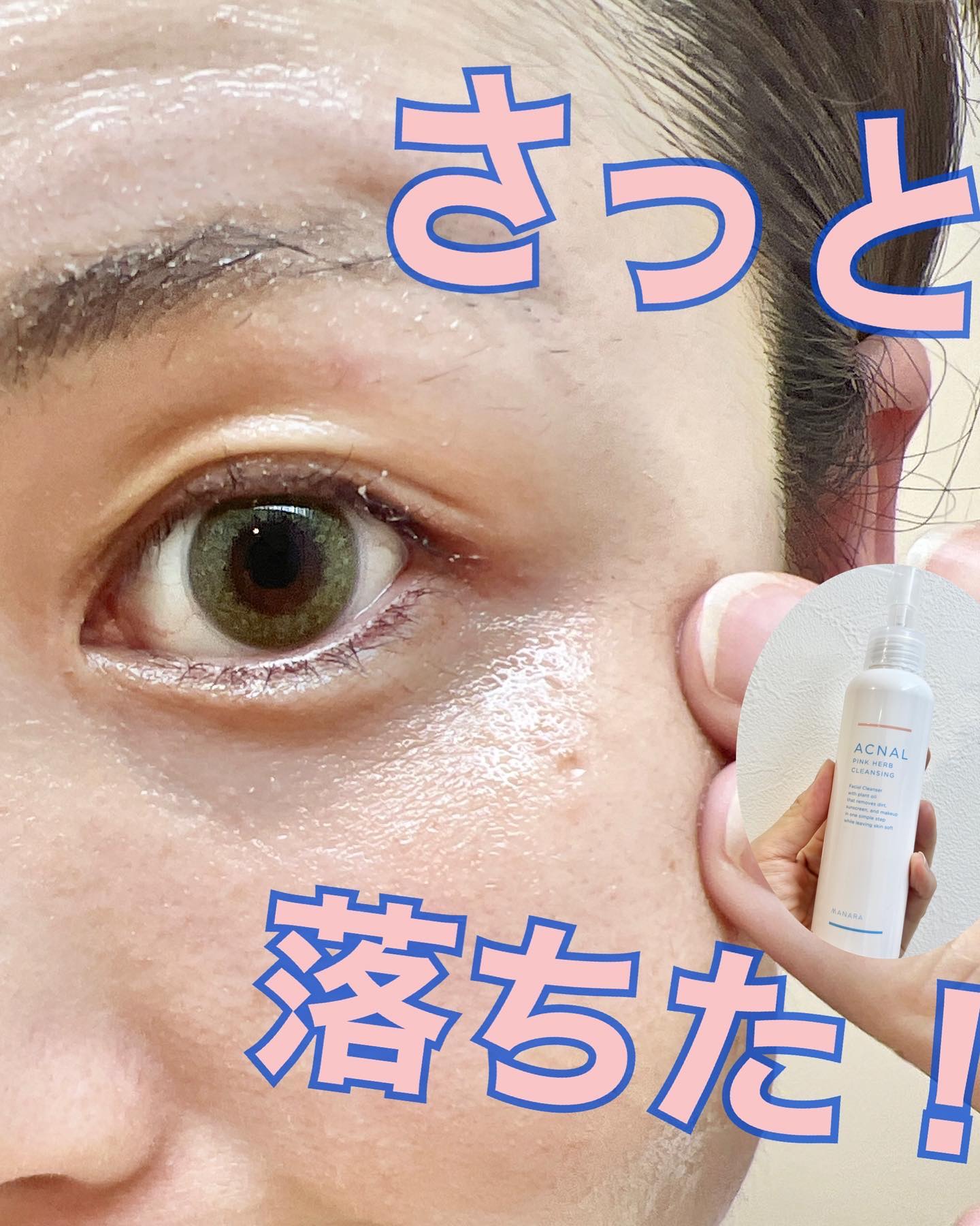 ピンクハーブクレンジング/ACNAL/オイルクレンジングを使ったクチコミ（2枚目）