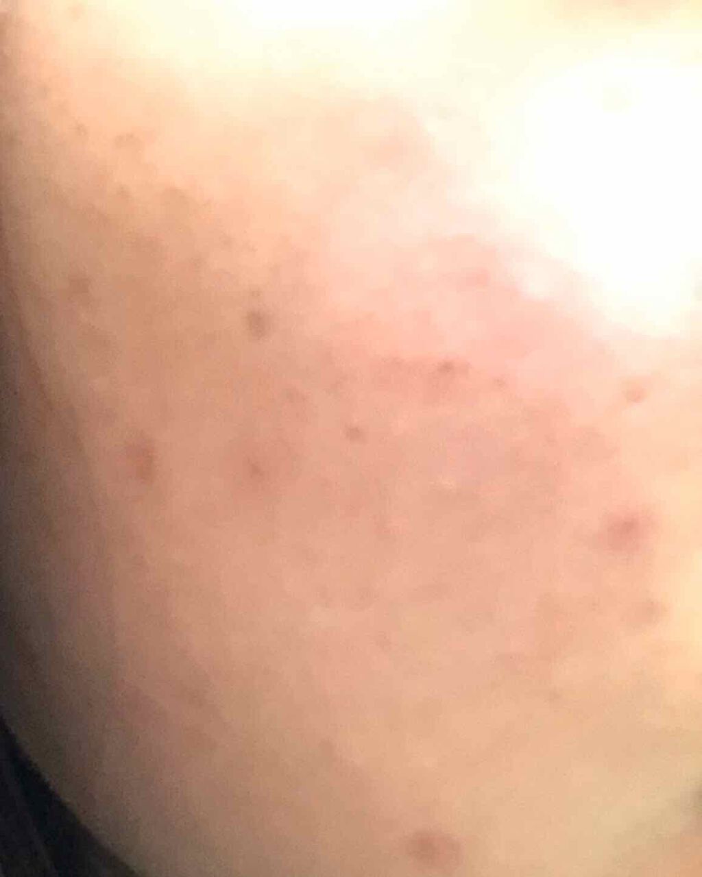 敏感肌用薬用美白美容液/無印良品/美容液を使ったクチコミ(2枚目)