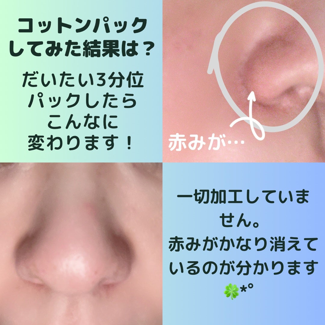 AHA·BHA·PHA 30デイズミラクルトナー/SOME BY MI/化粧水を使ったクチコミ(4枚目)