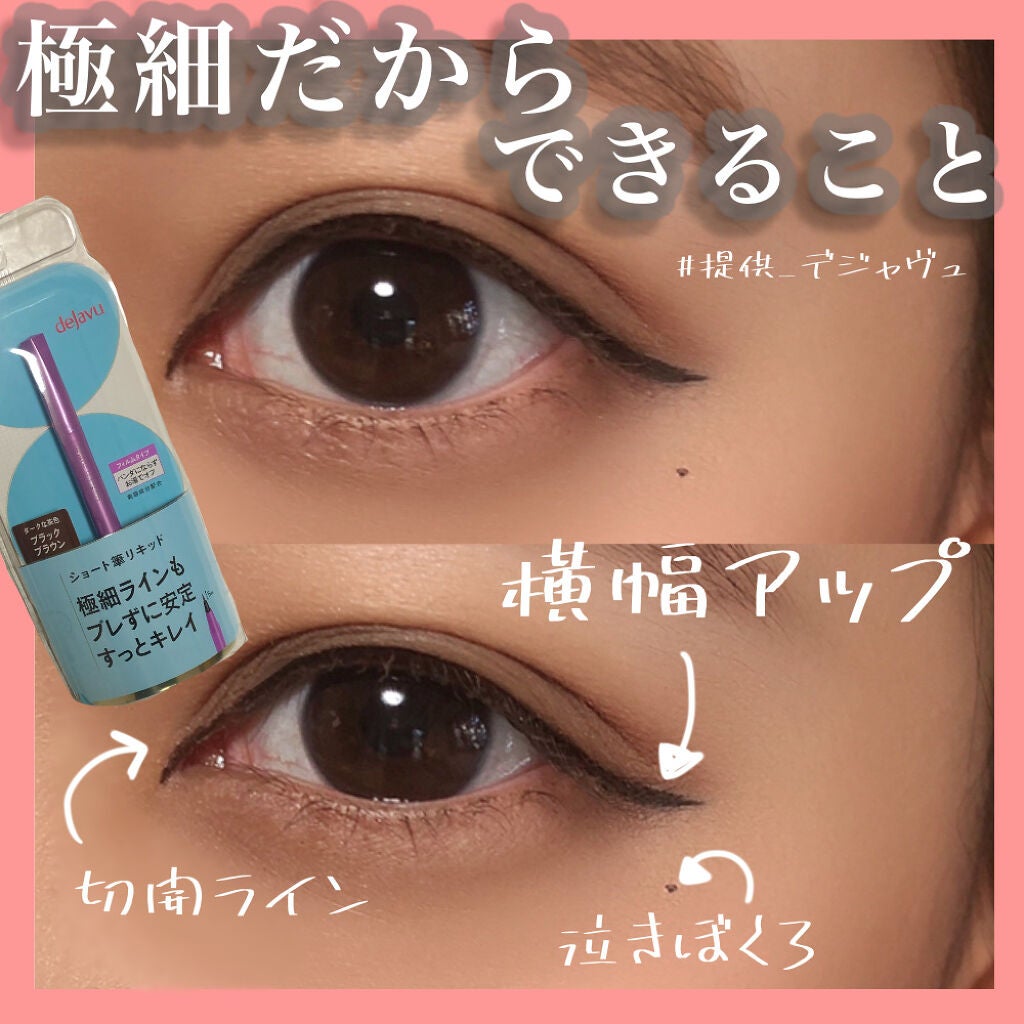 ãå¯çã¢ã€ã©ã€ããŒãã·ã§ãŒãçãªããã/ããžã£ãŽã¥/ãªãããã¢ã€ã©ã€ããŒã䜿ã£ãã¯ãã³ãïŒ1æç®ïŒ