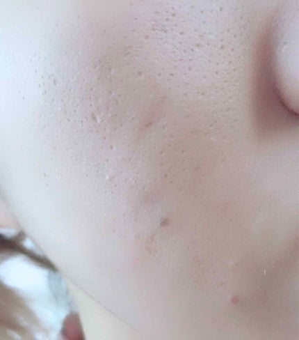 マシュマロフィニッシュファンデーション/キャンメイク/パウダーファンデーションを使ったクチコミ(3枚目)