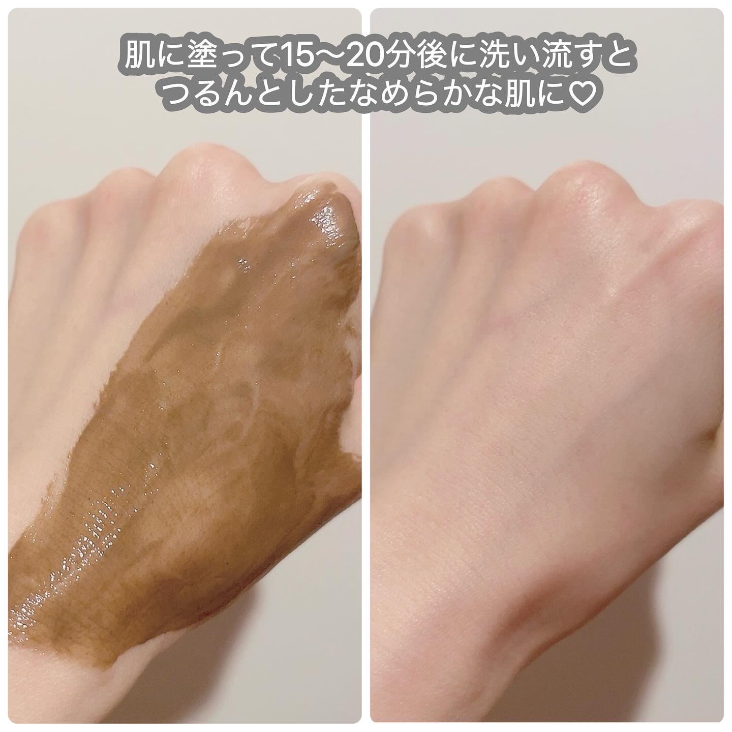 リカバリーマッドマスク/BRMUD/洗い流すパック・マスクを使ったクチコミ（3枚目）