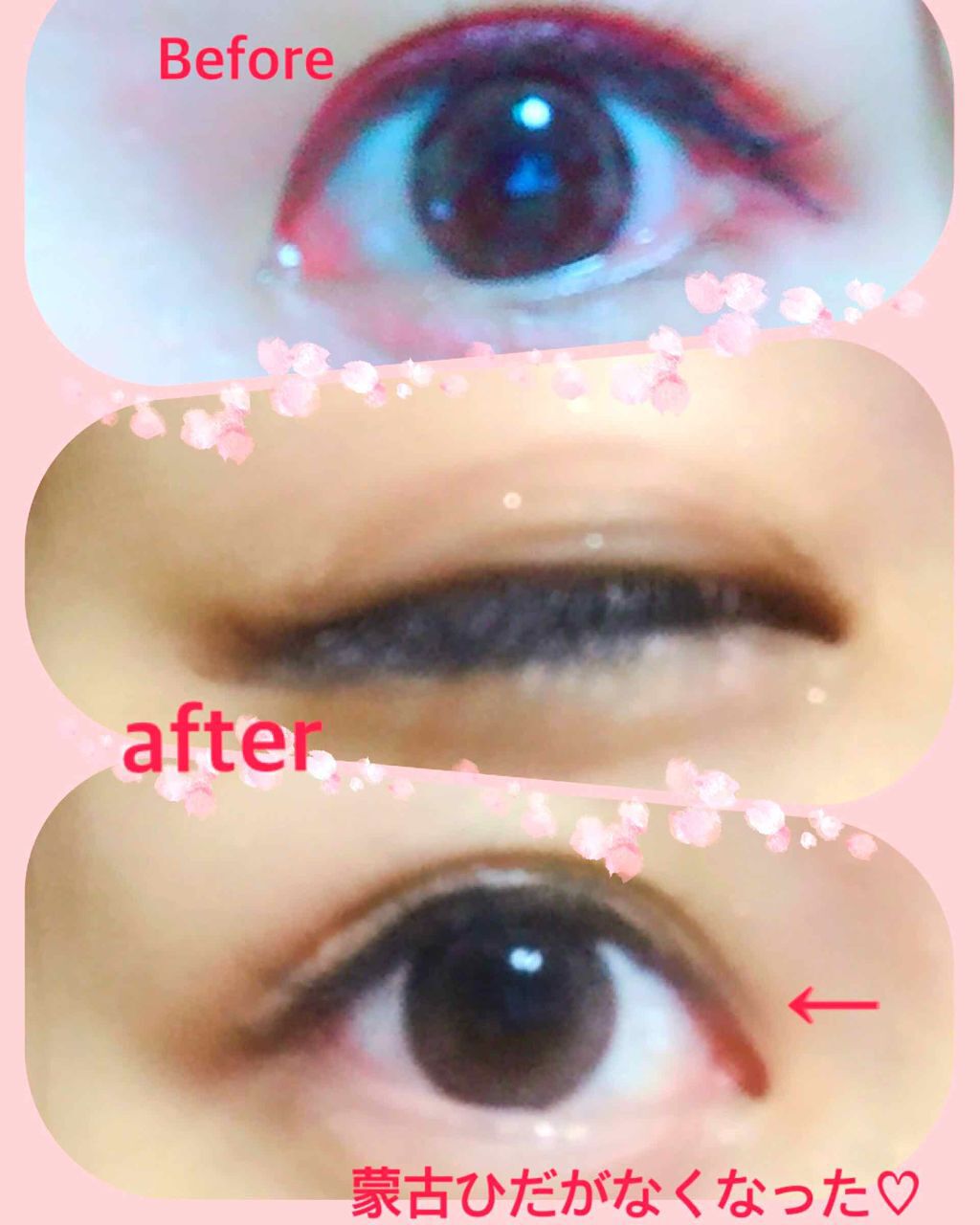 アイテープ(絆創膏タイプ、レギュラー、70枚)/DAISO/二重まぶた用アイテムを使ったクチコミ(2枚目)